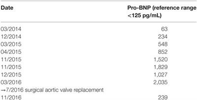 Aortic Valve Replacement for Moderate Aortic Stenosis with Severe Calcification and Left Ventricualr Dysfunction—A Case Report and Review of the Literature